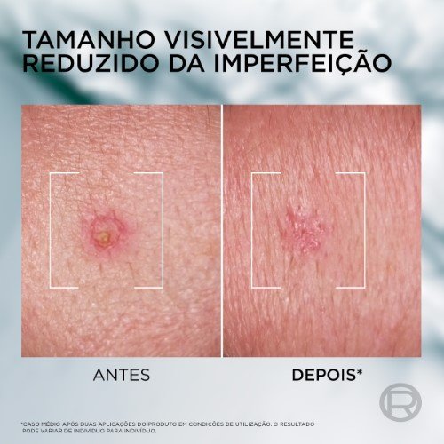 DG94031 ATF SOS 2 2400x2400